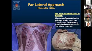 Far Lateral Approach - Microsurgical Anatomy - Part 2