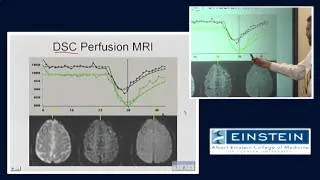 Introducing MRI: Perfusion Imaging (53 of 56)