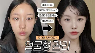 도대체 얼굴에 뭐했어요?😳 지금까지 받았던 시술 다 알려드림🔥 추천vs비추천 시술들 모음 ! | 소윤Soyoon