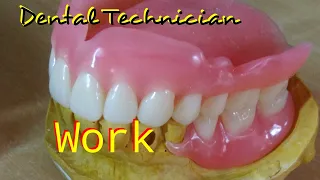 Dental Lab Technician Work.  Dental Technician WorldWide  DatuAmbasTv