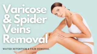 ♫ Get Rid of Varicose and Spider Veins + Water Retention and Pain Removal ~ Classical Music