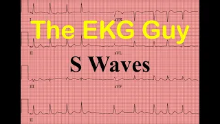 EKG/ECG S Waves - Question 24.0 | The EKG Guy