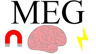 Magnetoencephalography: measuring brain activity with magnetism