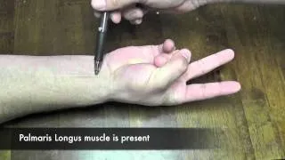 Two Finger Sign Test (CR)
