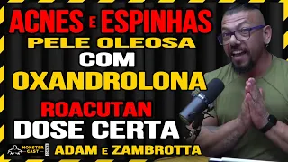 ELIMINE ACNES E ESPINHAS APÓS USO DE OXANDROLONA !! COMO USAR ROACUTAN !? | ADAM & ZAMBROTTA