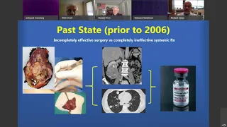 Urology Teaching Collaborative | 6/2/20 | Dr.  Robert Uzzo: Cytoreductive Nephrectomy in 2020