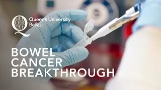 Bowel Cancer Breakthrough