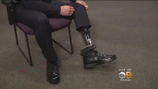 Only On 9: LAPD Officer Rejoins The Force After Losing His Leg, Defying The Odds
