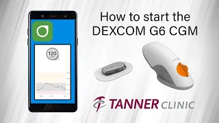 How to start the DEXCOM G6 CGM