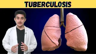 Tuberculosis TB disease | cause transmission pathogenesis symptoms treatment prevention | lung hindi