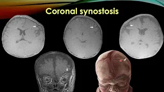 Imaging Techniques "What Do I Need To Consider?" Part1Head and Neck Imaging ASHNR20