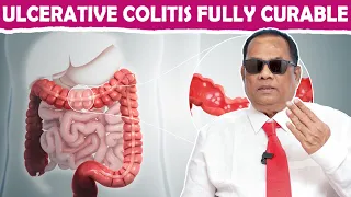 ULCERATIVE COLITIS FULLY CURABLE / DR.C.K.Nandagopalan