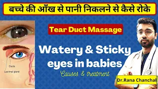 Sticky eyes in babies: Causes & treatment || Tear duct (NLD) Massage