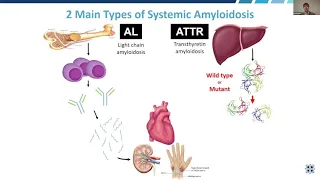 ASG Webinar Introduction and Agenda plus Overview of TTR Amyloidosis