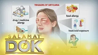 Salamat Dok: Causes and symptoms of urticaria