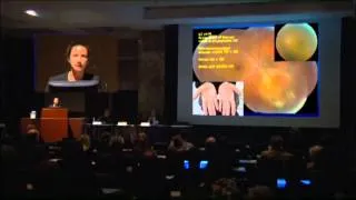 Mayo Clinic Ophthalmology Retina Update and Case Conference: Diagnosis of Uveitis - Dr. Smith