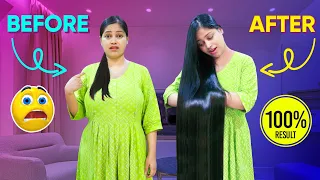 😓अगर मैं ये Trick ना करती तो पूरी गंजी हो जाती 🙆🏻‍♀️ Hairfall se Bachane ke liye ye Trick Zarur Kare