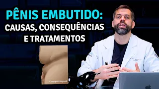 Pênis embutido: causas, consequências e tratamentos | Dr. Marco Túlio Cavalcanti