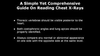 How To Read A Chest X-Ray | A Simple Guide On Reading Chest X-Rays | Chest Radiography Lecture Notes