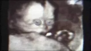 "Ultrasound Video" Demon baby kills his mother from inside the womb