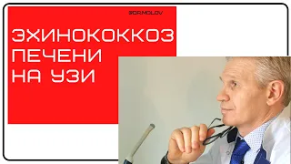 Эхинококкоз печени на УЗИ. УЗИ брюшной полости