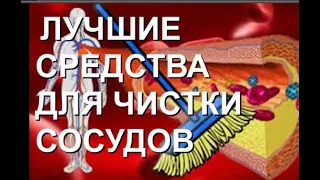 ЛУЧШЕЕ НАРОДНОЕ СРЕДСТВО ДЛЯ ЧИСТКИ СОСУДОВ