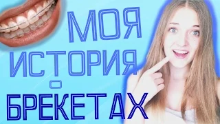 Брекеты. Моя история!Мне сняли брекеты!