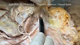 ANTERIOR CERVICAL REGION STRAP MUSCLES NECK TRIANGLES and Clinical Aspects – Sanjoy Sanyal