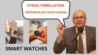 Smart Wearables & heart beats Part 3: AFib and VTac