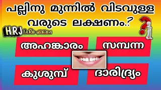 പല്ലിനു മുന്നിൽ വിടവുള്ളവരുടെ ലക്ഷണം .?? 😳| Malayalam quiz | HRJ Info vision  #psctips