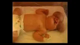 Baby born with brain outside skull