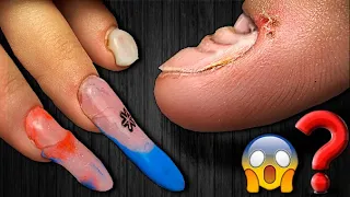 😱 scary on the nails.❌ NAILS AT 13?! New! Very Durable Nail Extension.GEL NAILS