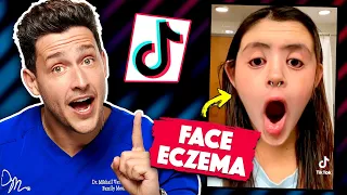 Shocking Medical Conditions On TikTok