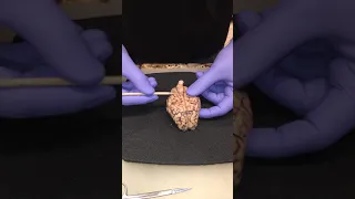 Goat Brain Dissection by Steve Whiddon