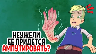 Можно ли отлежать руку или ногу насовсем?