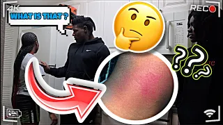 HICKEY PRANK ON BIG BROTHERS! *THEY GOT MAD*😳