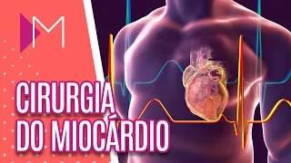 Cirurgia de revascularização do miocárdio - Mulheres (20/04/18)