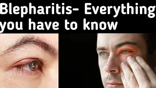 What is blepharitis - Blepharitis symptoms, Causes, Diagnosis And Blepharitis treatment