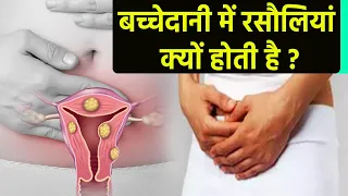 Uterus में गांठ होने के Symptoms चौंका देंगे | Uterus mei gaanth kyu hoti hai ? | Boldsky