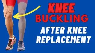 3 Exercises To Fix Knee Buckling & Why Does It Happen: Knee Replacement