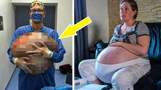The woman gave birth. When the doctors took a closer look, they realized that it was not a child!