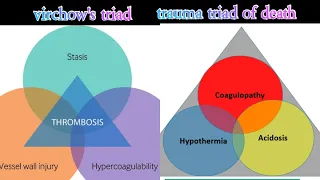 Virchow's Triad & Trauma triad of death