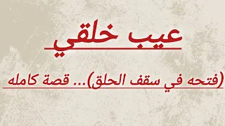 عيب خلقي ( فتحة في سقف الحلق )..!! قصة كاملة