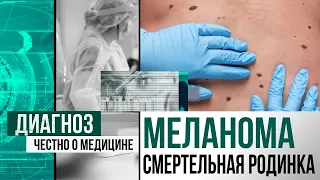 Прожить ещё месяц: как казахстанские пациенты с меланомой борются за жизнь | Диагноз