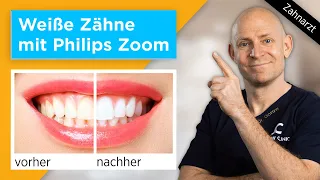 So schädlich ist Zahnbleaching | Das ist die Wahrheit