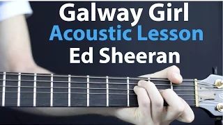 Galway Girl - Ed Sheeran: Acoustic Guitar Lesson