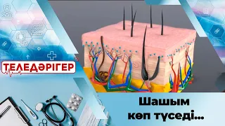 «Теледәрігер». Шашым көп түседі...