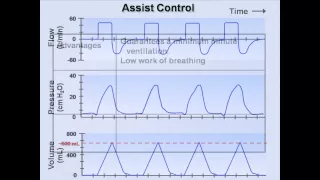 Ventilator Modes (Mechanical Ventilation - Lecture 7)