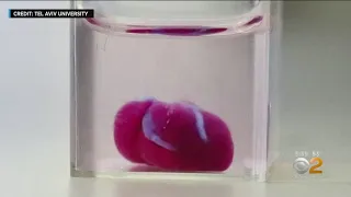 Lab Creates 3D-Printed Heart, Sign Of Future For Organ Transplants