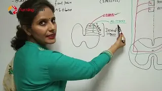 PAIN PATHWAY/ Ascending Tracts 4/4